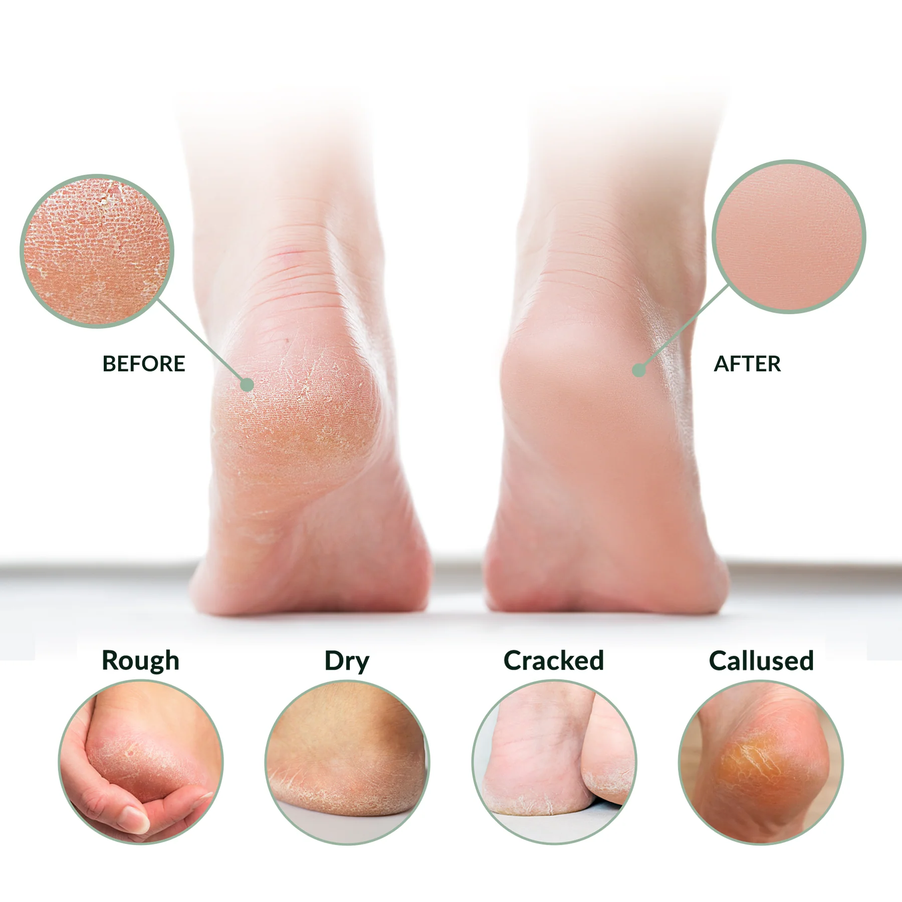 Advanced Crack Defense Deep Moisturizing Heel & Foot Cream - Image 4