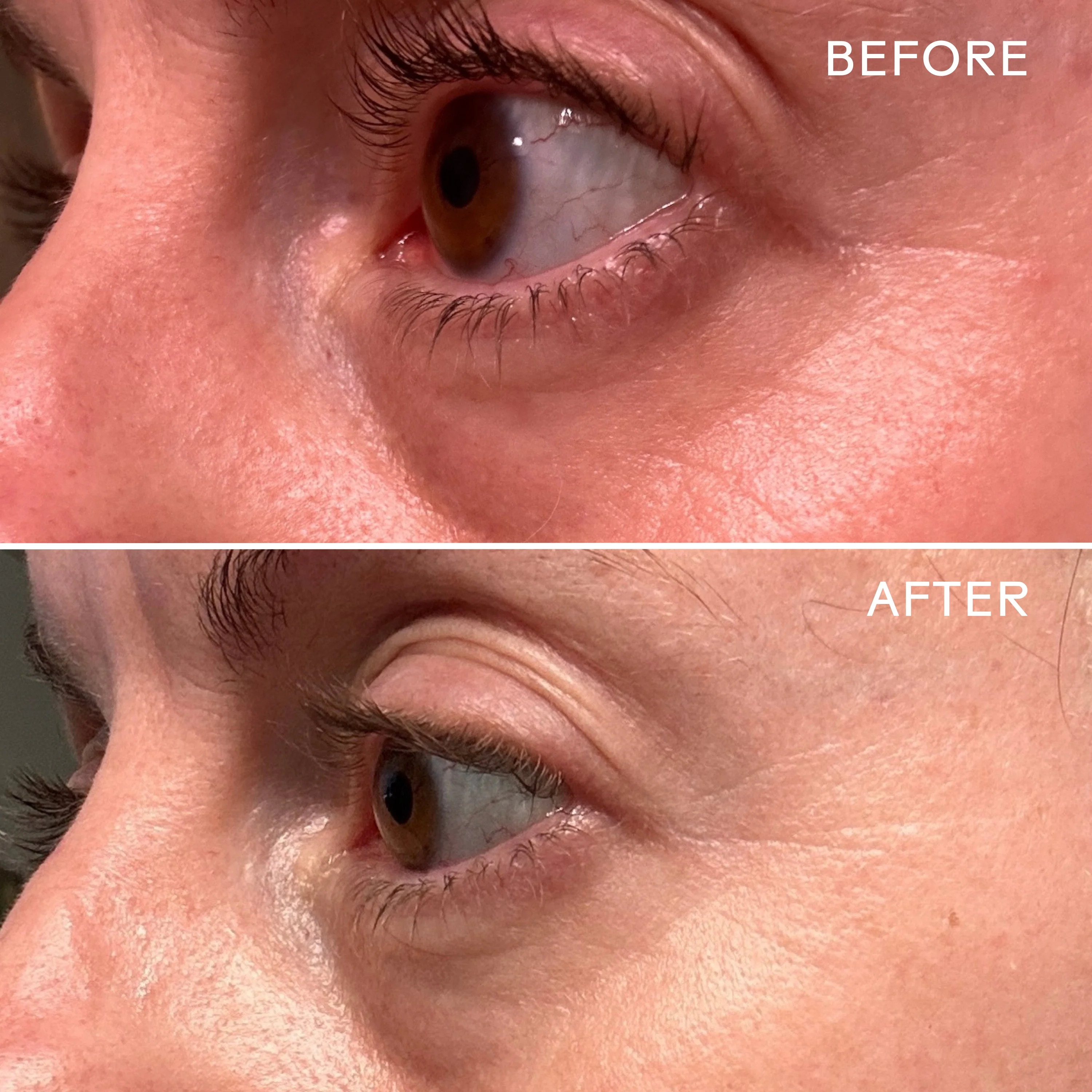 EyeHero™ Bio-Retinol Smoothing Eye Cream - Image 2