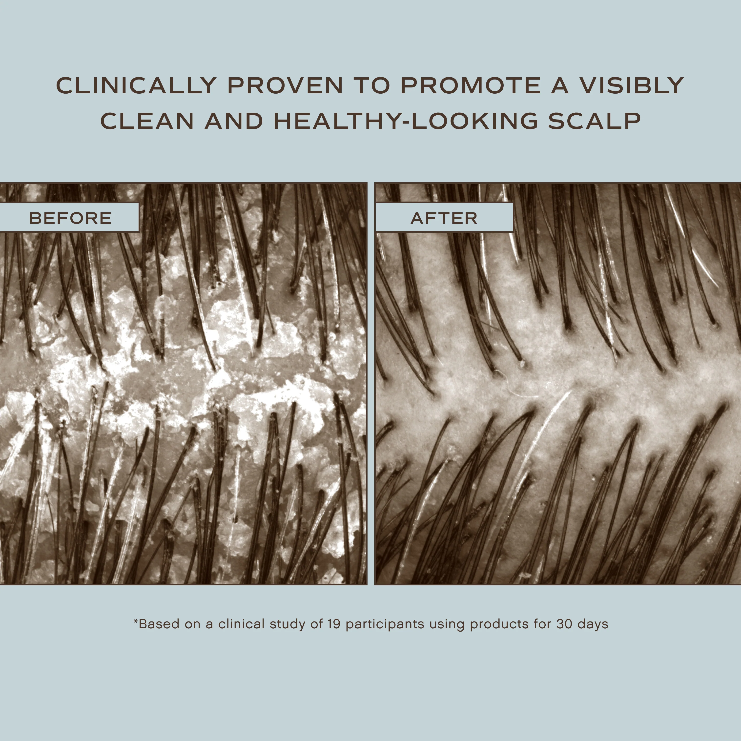 Hair Renew Scalp Hairbath - Image 2