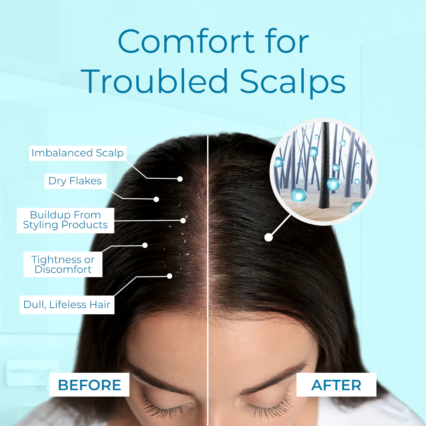 Tea Tree Scalp Spray, Calming Spray for Dry, Itchy or Flaky Scalp - Image 4