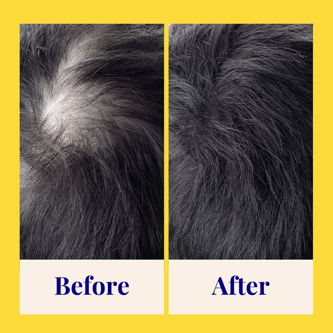 Invigorating Powder Shampoo for Thinning & Ageing Hair - Image 16