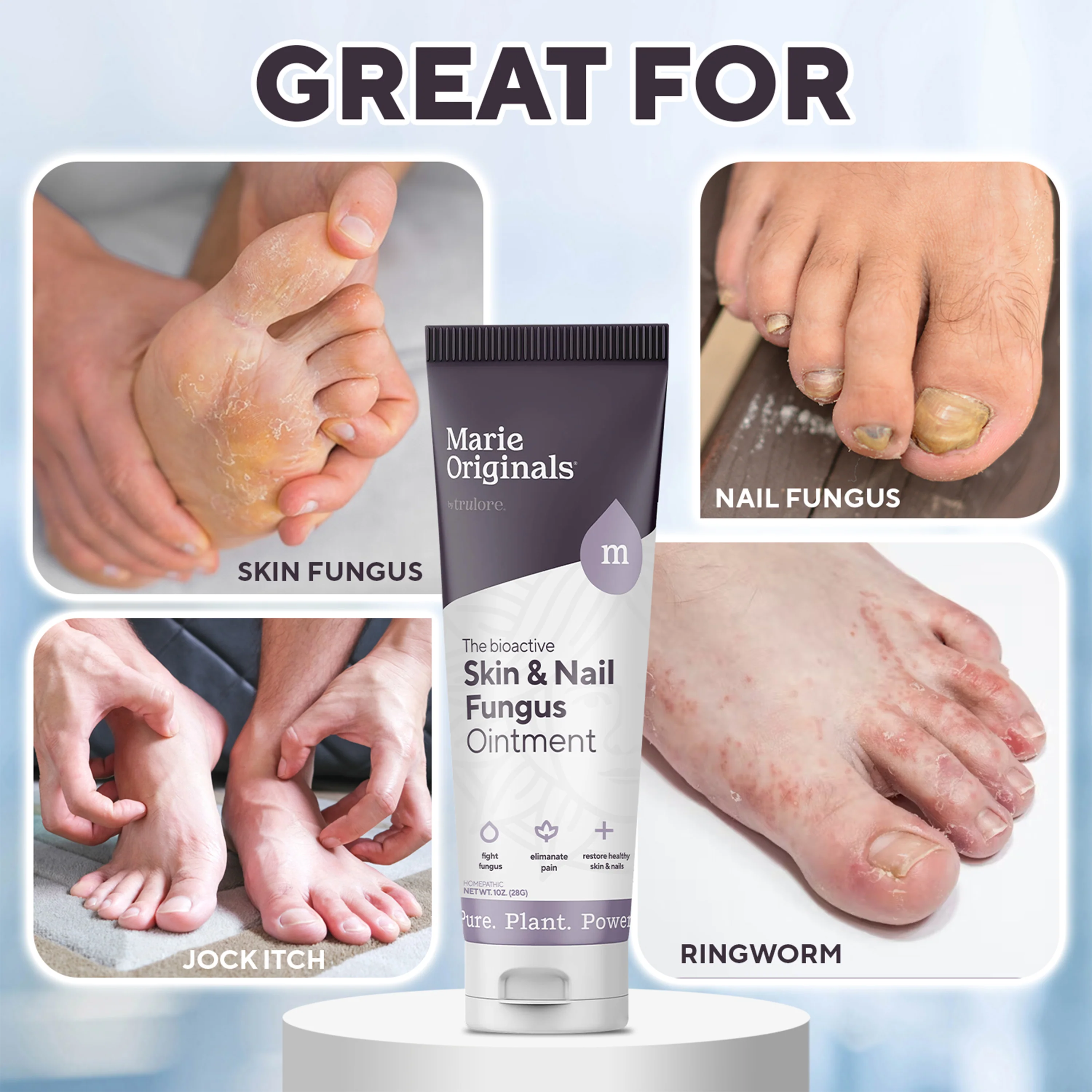 Skin & Nail Fungus Removal Cream - Image 4