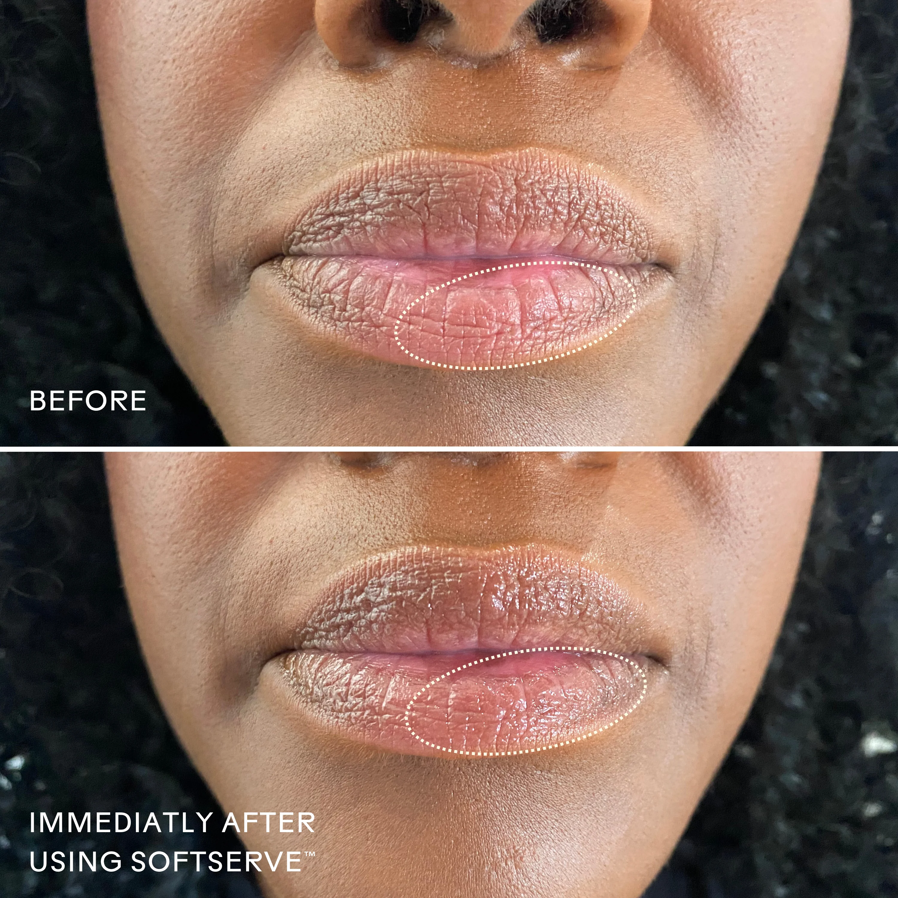 SoftServe™ Barrier-Building Lip Treatment - Image 8