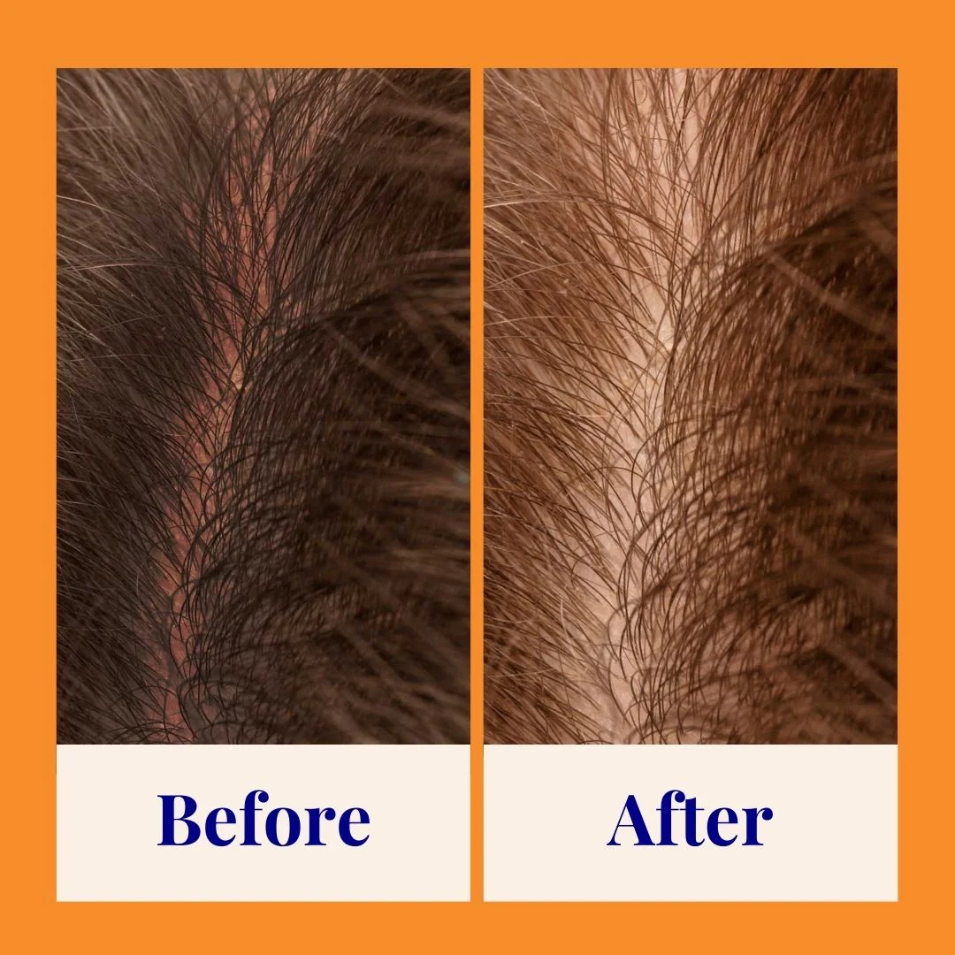 Strengthening & Soothing Powder Shampoo - Image 18